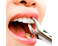 Можно ли курить кальян после удаления зуба?